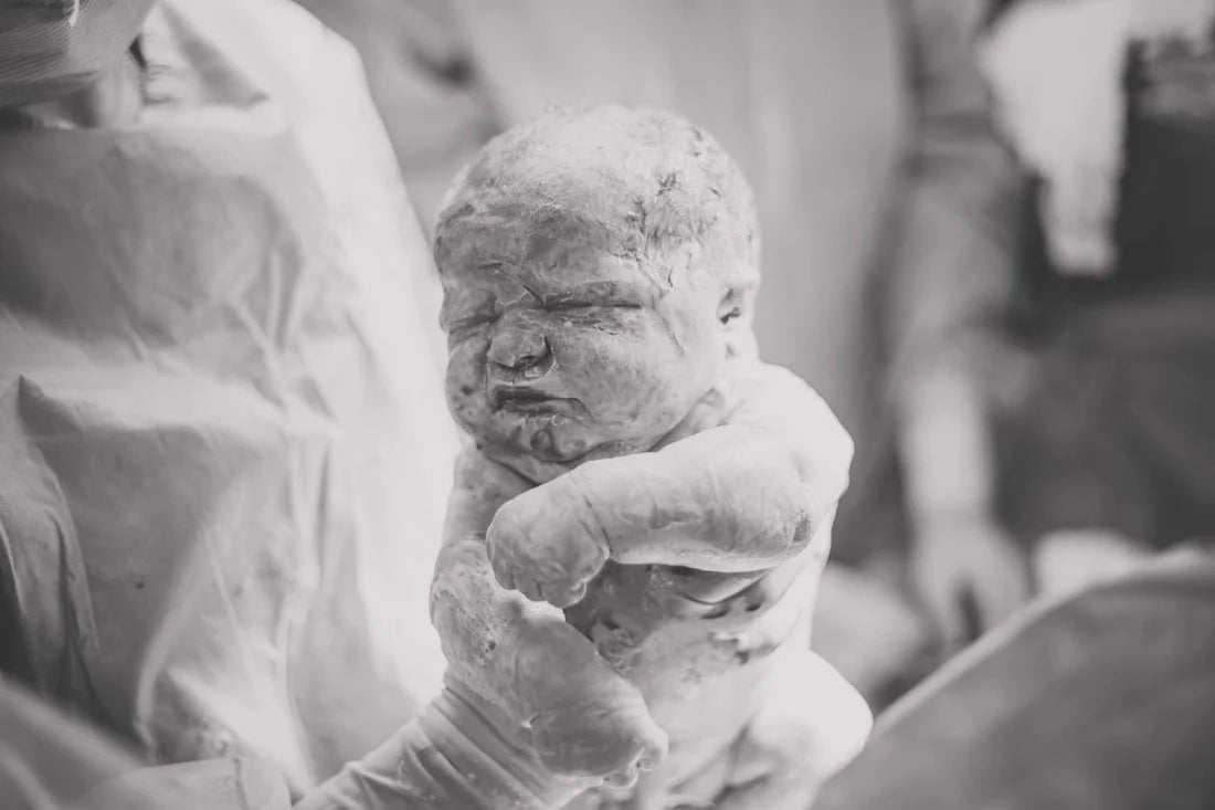 The Vernix